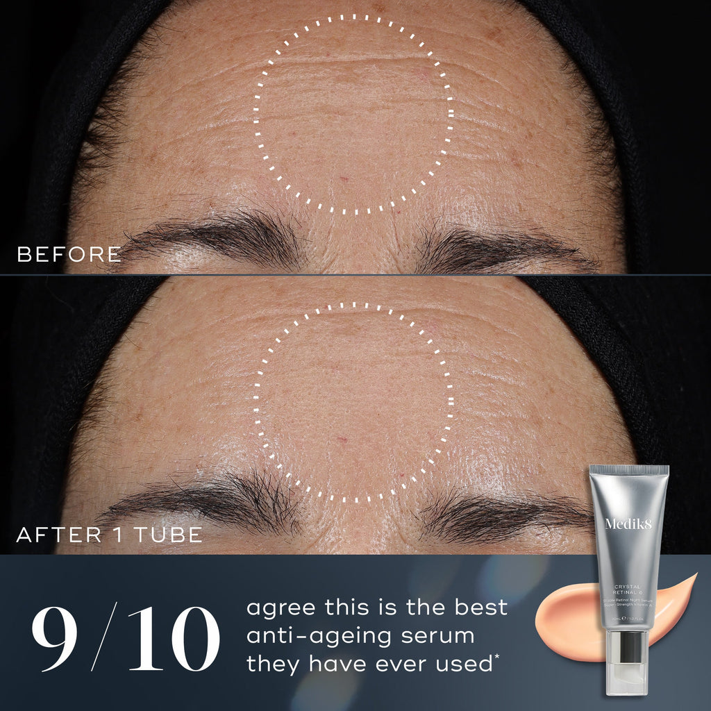 Cristal Retinal®